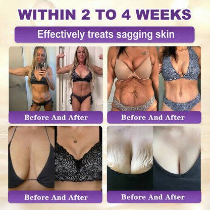 Roller Massage Neck Cream 🧴 Collagen & Hyaluronic Acid | Firms Neck, Reduces Wrinkles & Double Chin