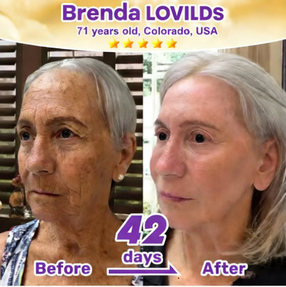 Roller Massage Neck Cream 🧴 Collagen & Hyaluronic Acid | Firms Neck, Reduces Wrinkles & Double Chin