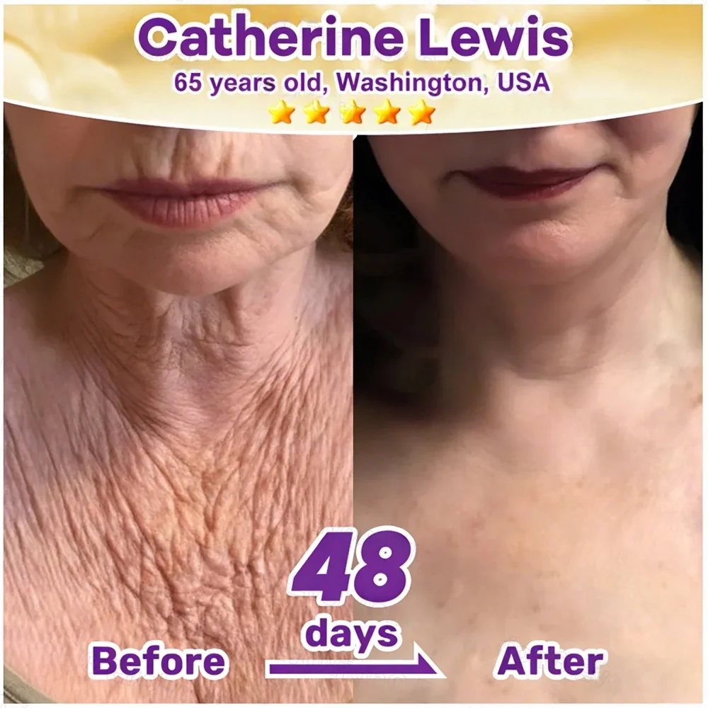 Roller Massage Neck Cream 🧴 Collagen & Hyaluronic Acid | Firms Neck, Reduces Wrinkles & Double Chin